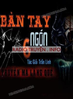 Bàn Tay 6 Ngón